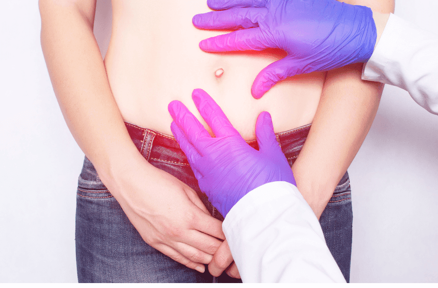 Hernia Remedy Without Surgery