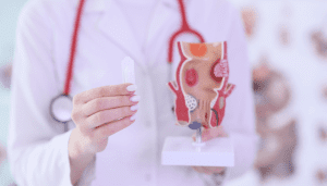 What Do Hemorrhoids Look Like