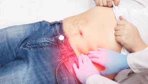What does a diverticulitis attack feel like