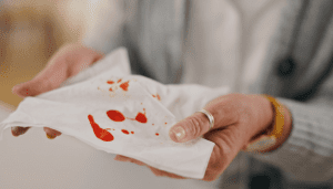 How Much Hemorrhoid Bleeding Is Normal