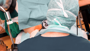 Doctor performing Hemorrhoid Surgery